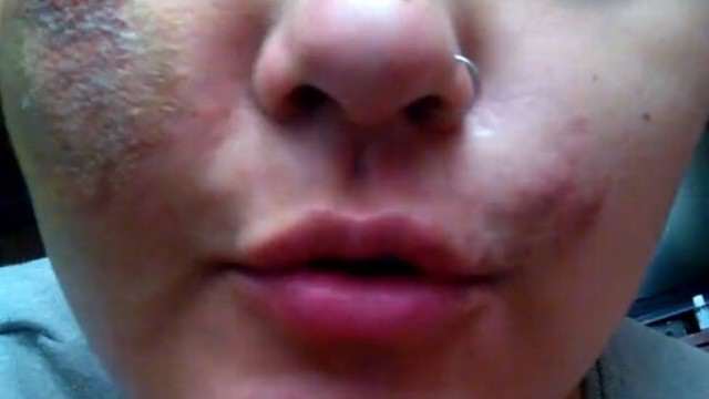 Adolescente usa rede social para denunciar agressão por ser homossexual