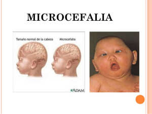 Microcefalia 2