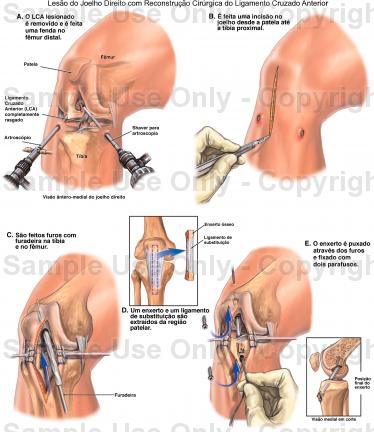 Problemas no Joelho 3