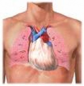 Hipertensão Arterial Pulmonar 5