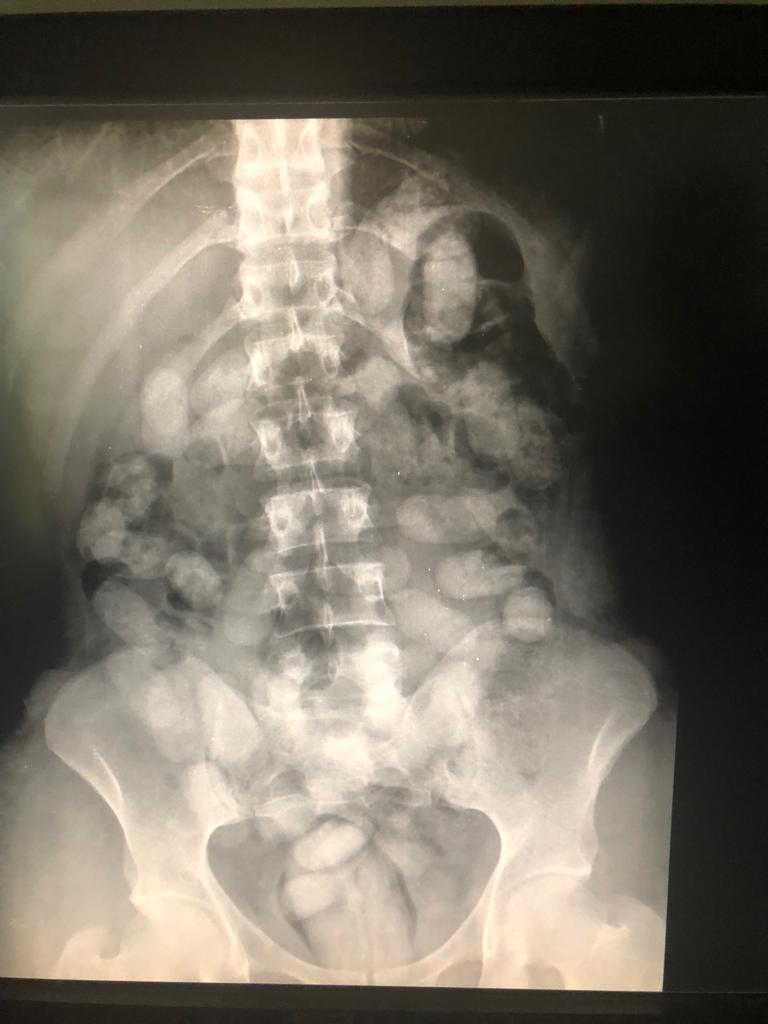 Homem é preso ao tentar embarcar com drogas, em Viracopos