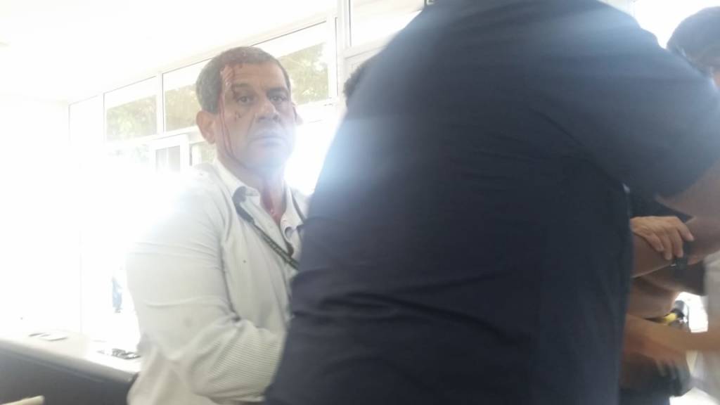 Manifestantes brigam no pedido de cassação de Jonas