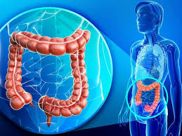 Câncer de Colo Retal 1