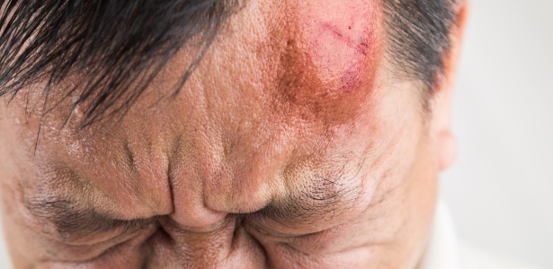 Pesquisa mostra calo na cabeça