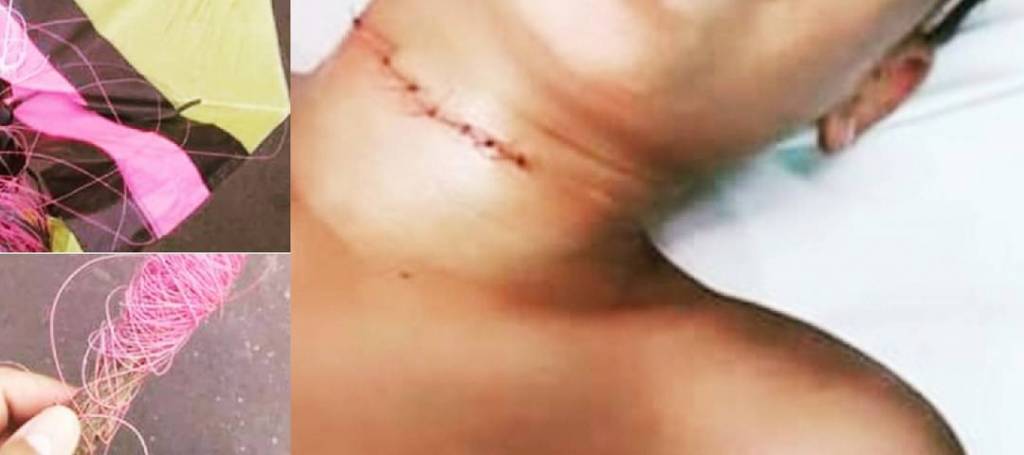 Mesmo proibida, venda de linha com cerol ou chilena é anunciada livremente na internet