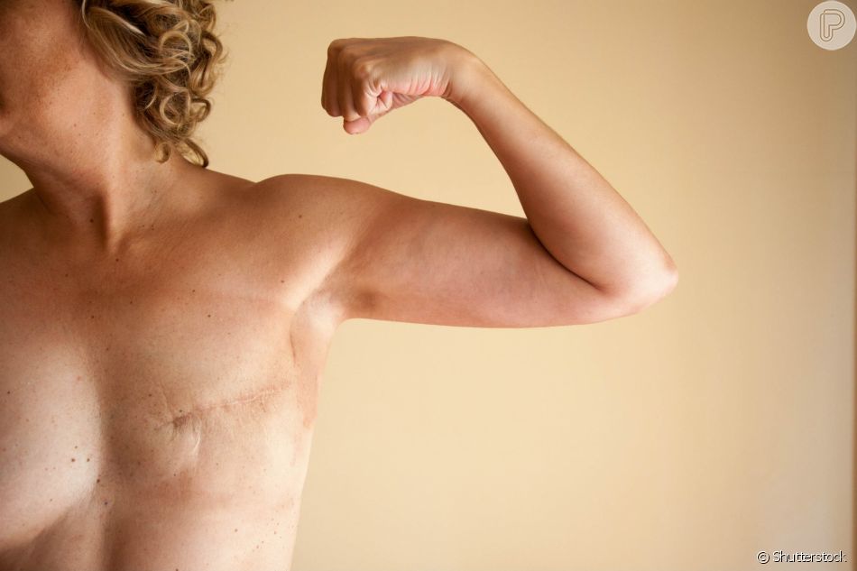 Reconstrução de Mama 2