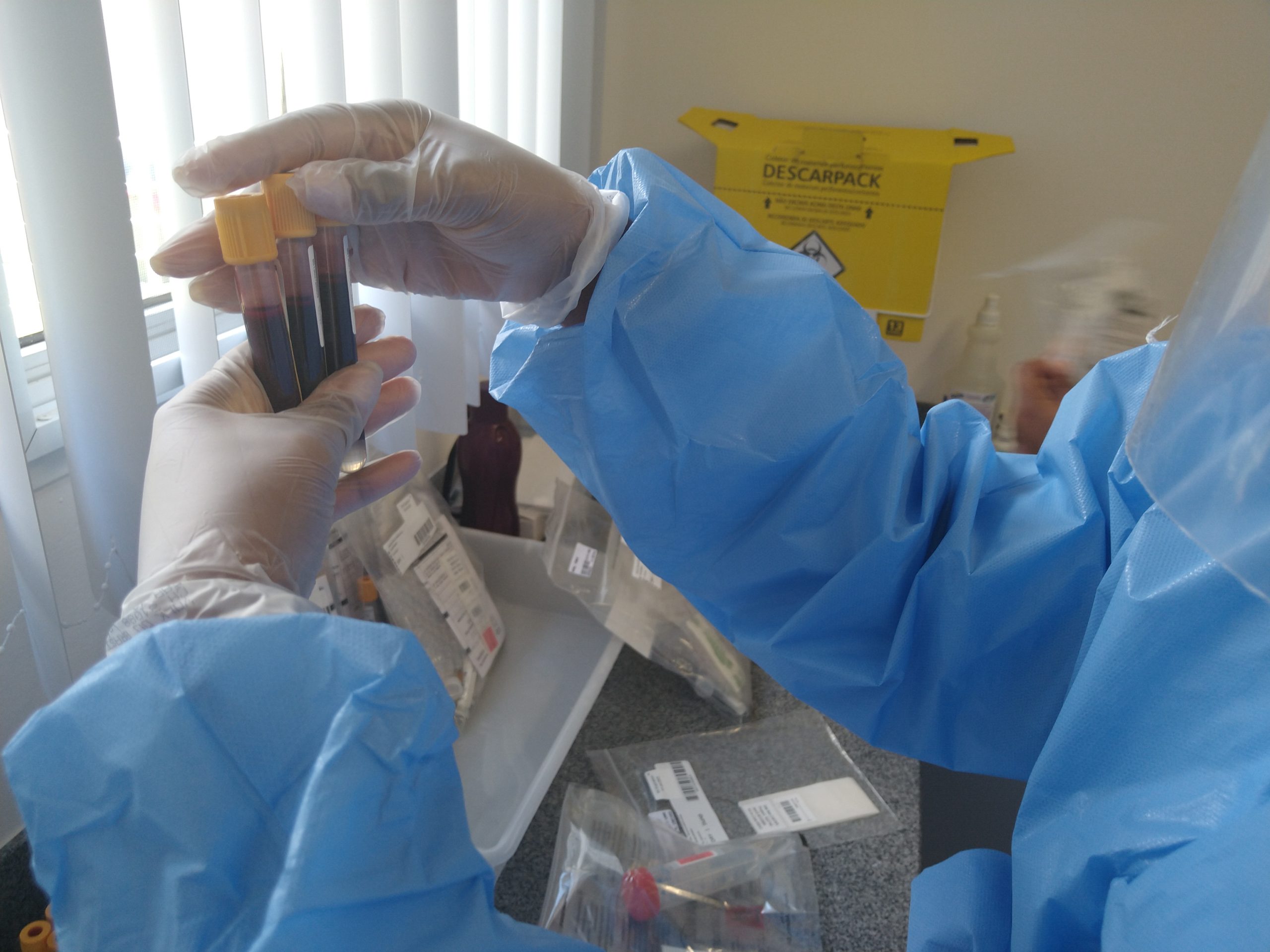 Valinhos e Itapira registram casos da variante Delta