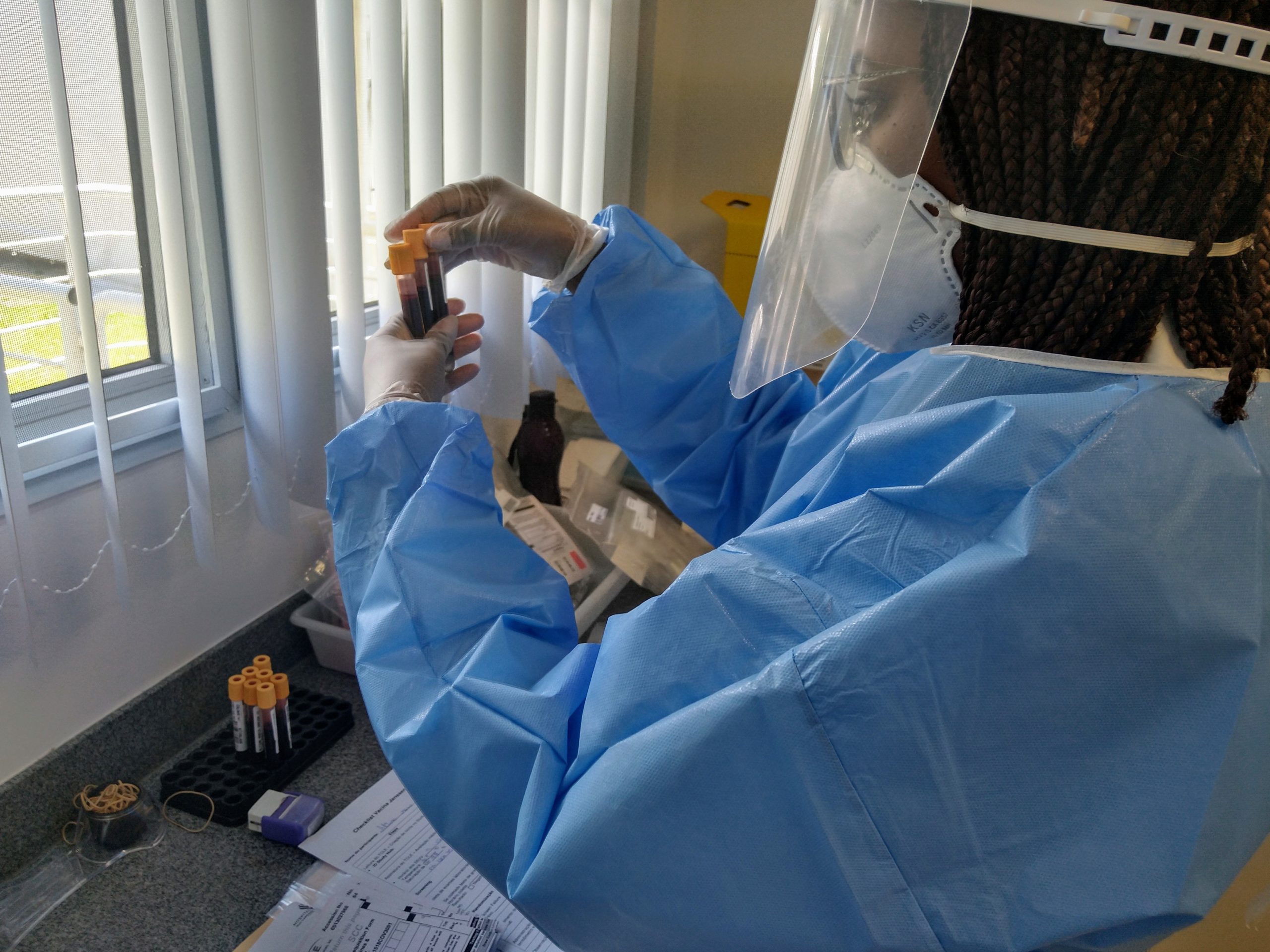 Voluntários reagem bem a vacina contra a covid-19