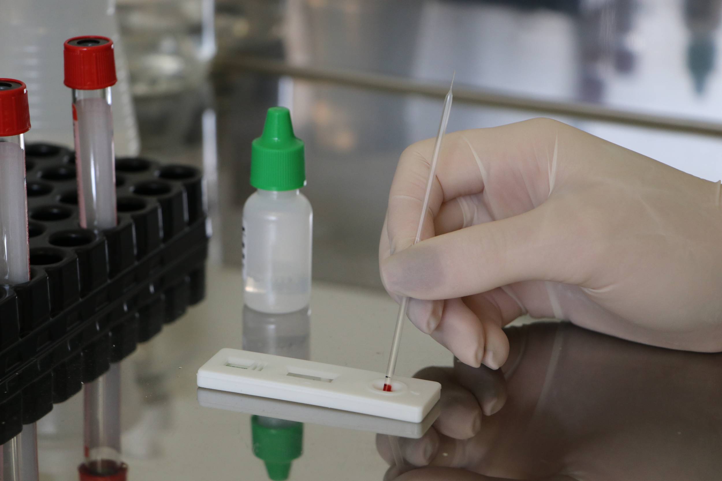 Piracicaba registra primeiro caso da variante Ômicron