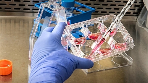 Campinas confirma mais 6 casos de varíola dos macacos e chega a 72