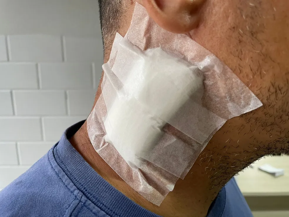 Homem atingido por tiro no pescoço vai ficar com a bala alojada