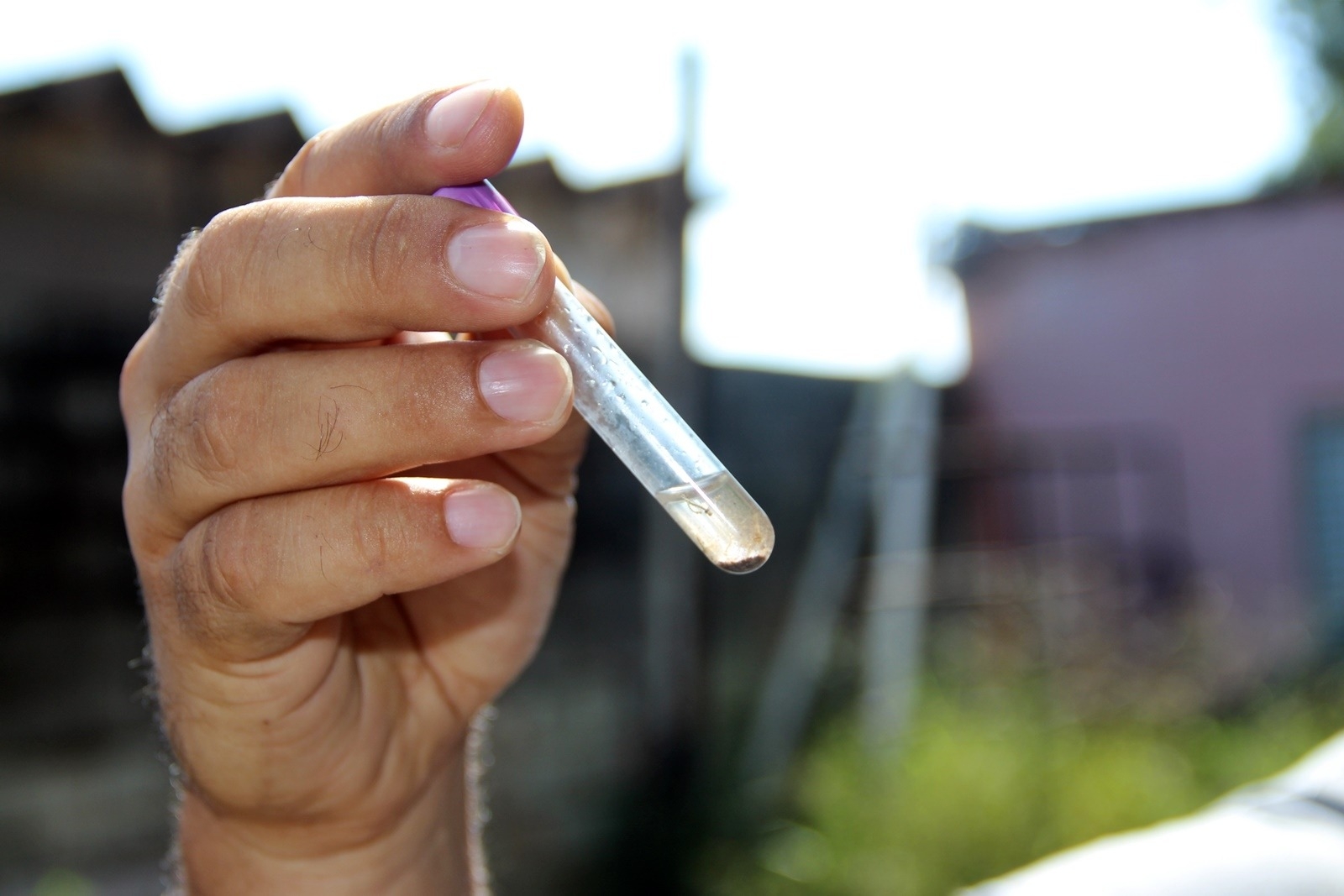 Piracicaba confirma mais uma morte por dengue em 2024