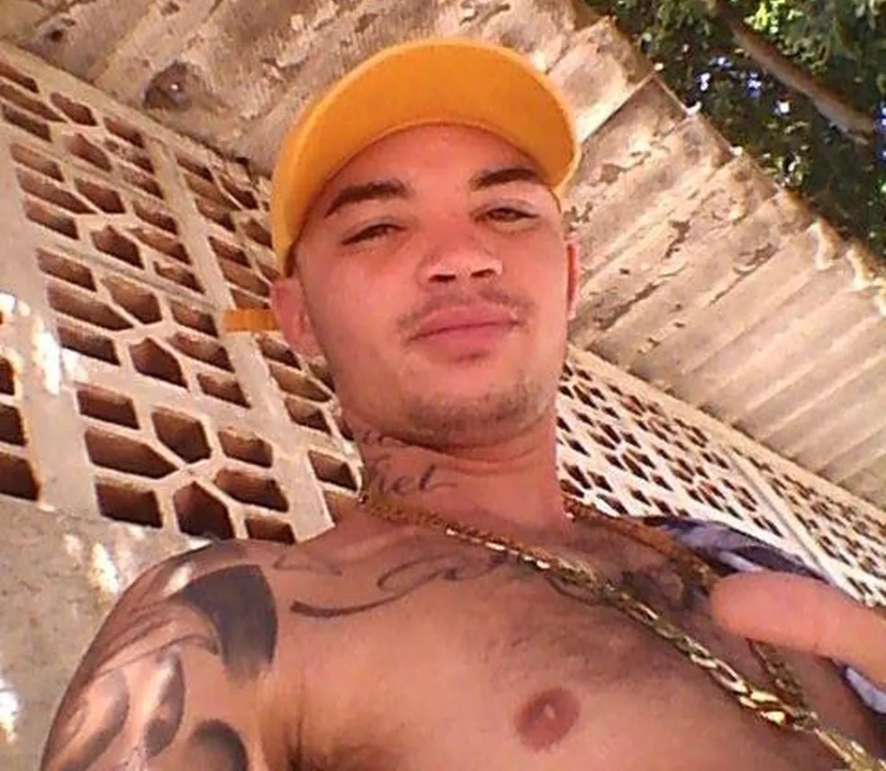 Morre jovem que teve 50% do corpo queimado após explosão de tacho em Santa Bárbara D’Oeste