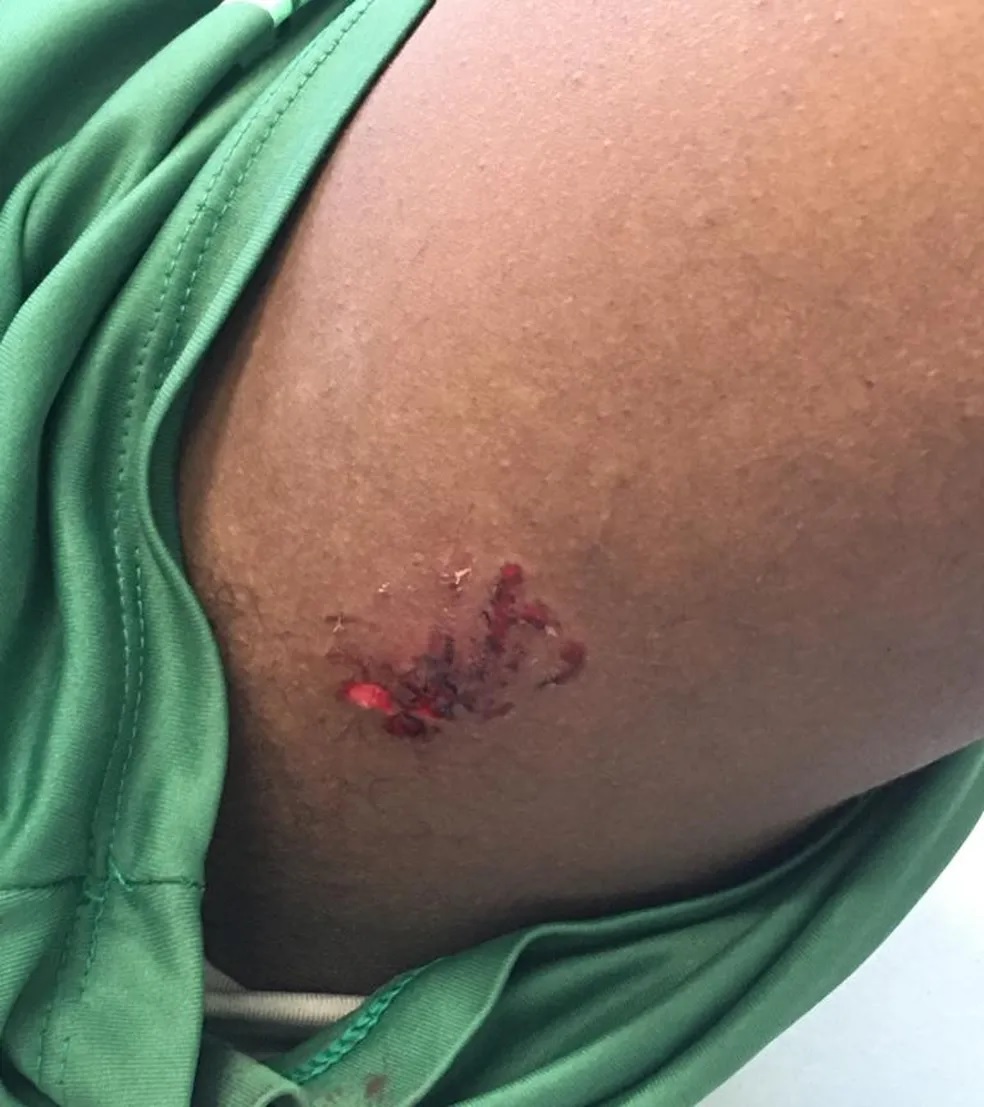 Filhotes de pitbull atacam jogadores da escolinha do Guarani