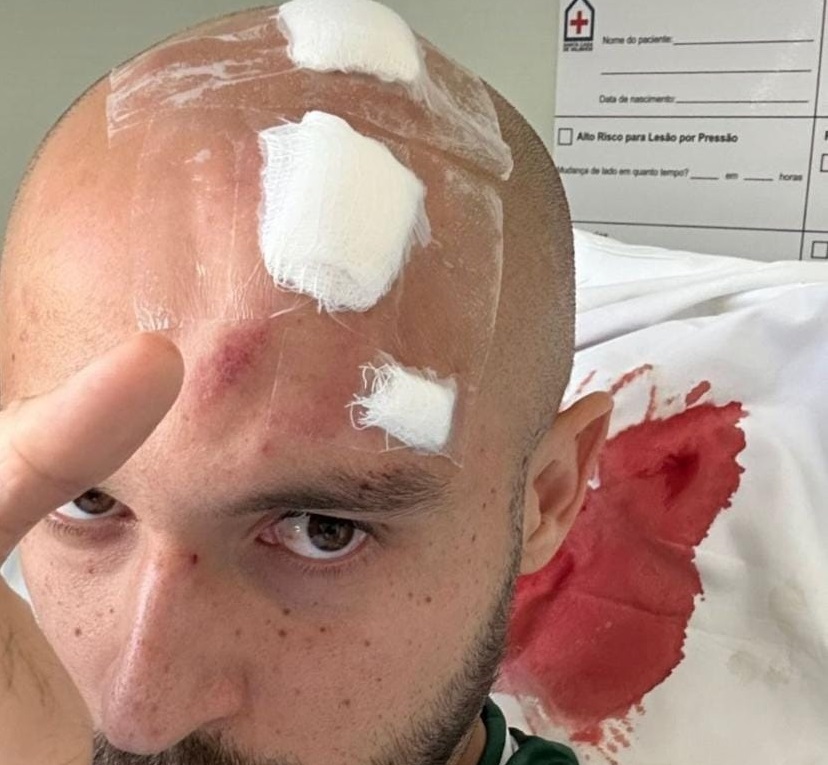 Régis se recupera bem após deixar jogo do Guarani em ambulância