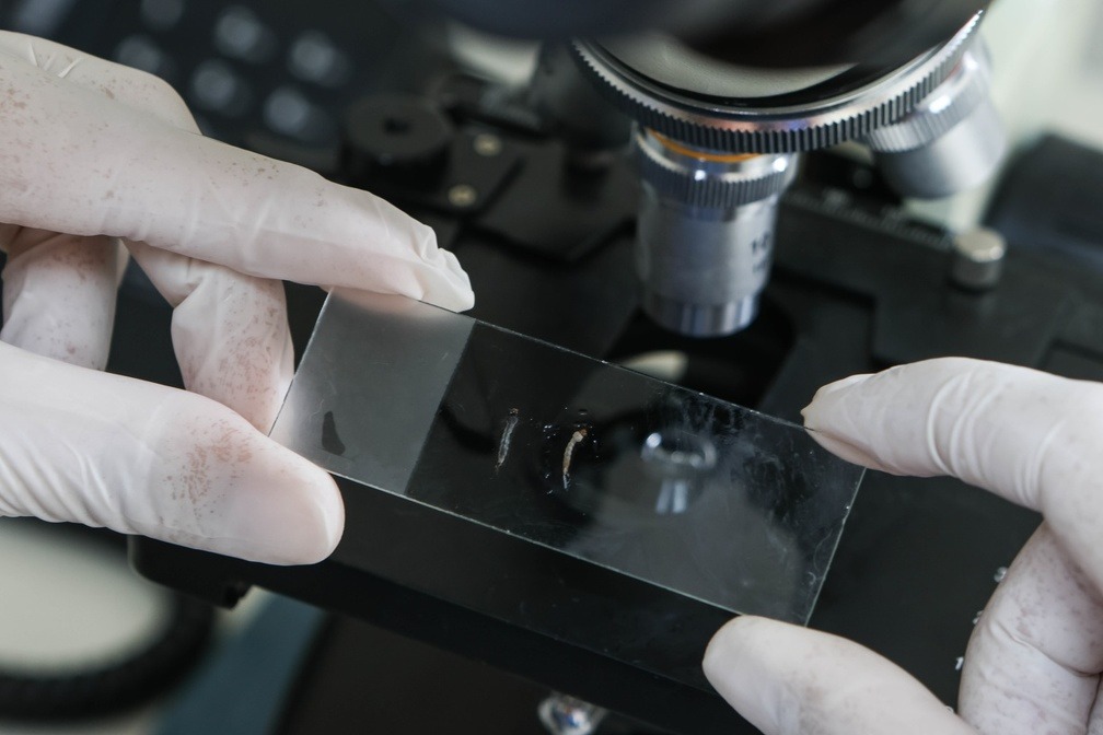 Campinas confirma 2° caso importado de chikungunya em 2024