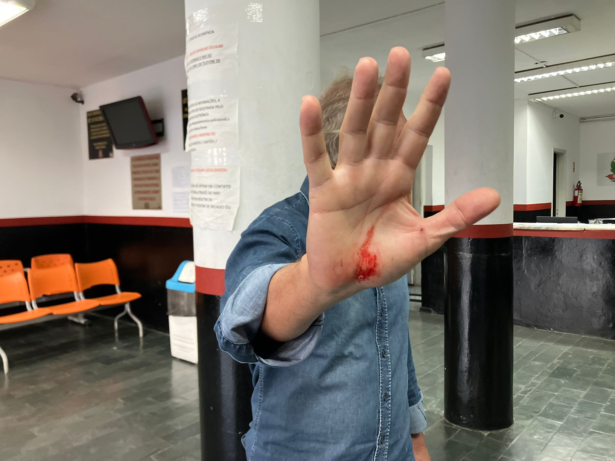 Homem sofre ferimento ao ser assaltado no Parque Ecológico de Campinas