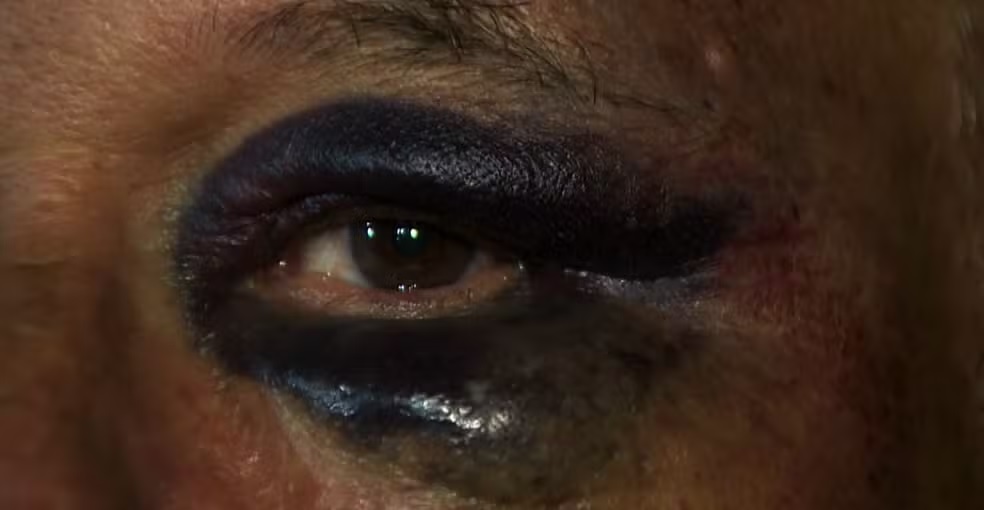 Idoso é agredido durante assalto em Campinas; vítima foi abordada no Centro