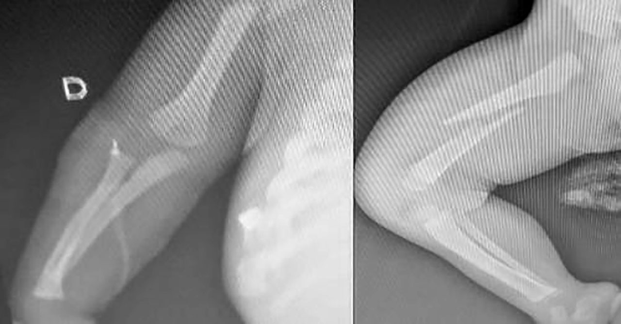 Pai é preso após agredir bebê de seis meses em Limeira; motivo seria “choro constante’