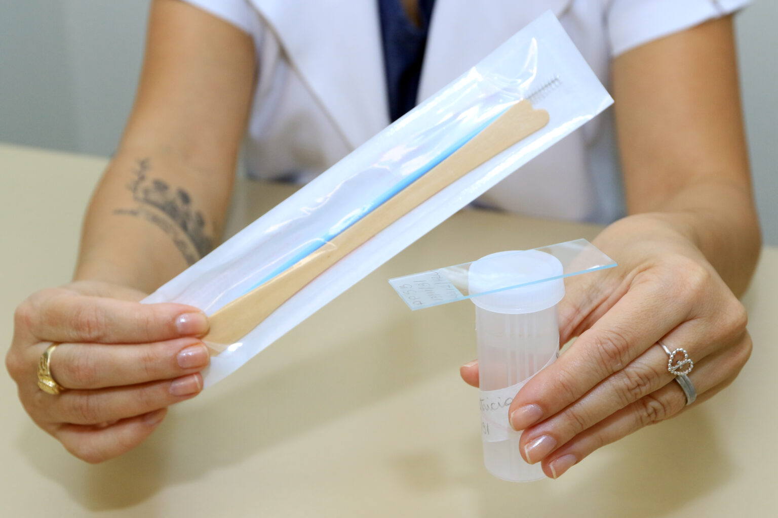 Campinas: 200 mil mulheres estão com exame do Papanicolau atrasado; saúde fará busca ativa