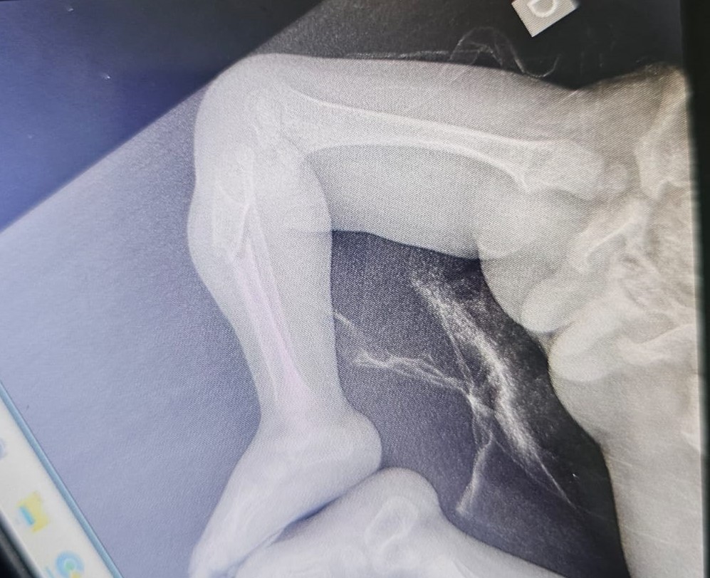 Padrasto é preso por suspeita de maus-tratos a bebê em Campinas 