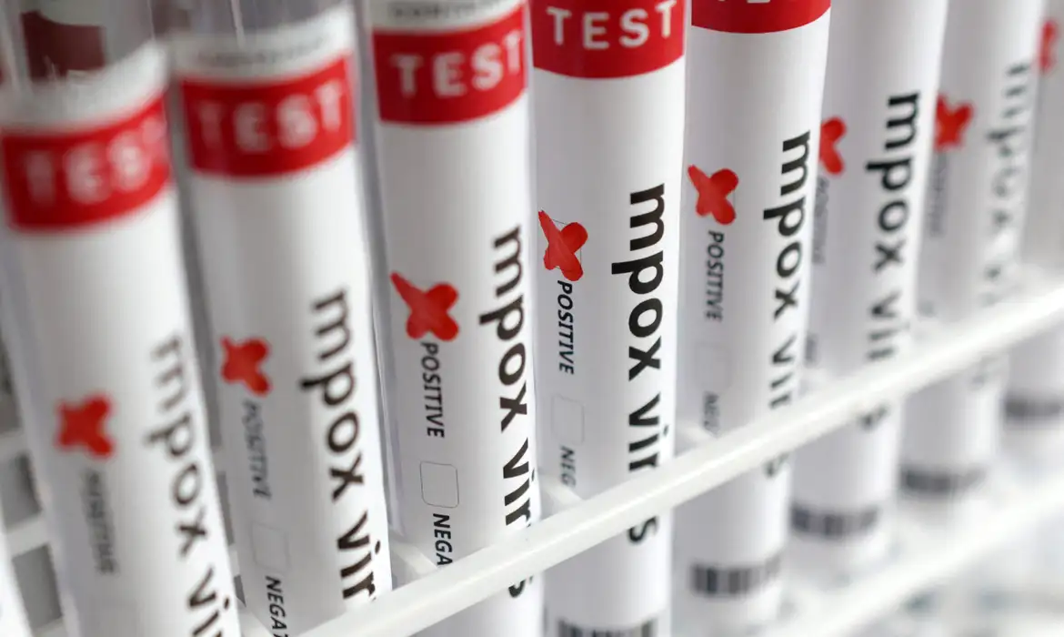 Região de Campinas tem 6 casos de Mpox este ano; Estado faz alerta