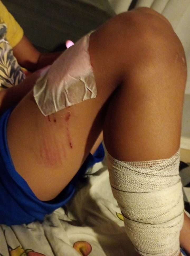 Crianças ficam feridas após ataque de cachorro em Monte Mor