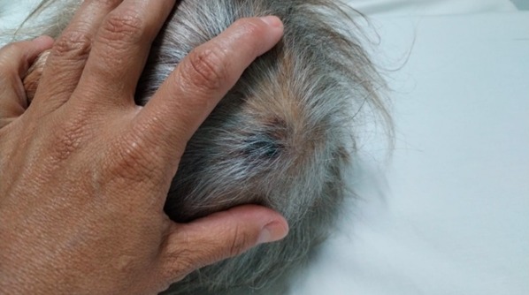 Justiça determina internação para idosa que sofreu queda em hospital de Jaguariúna