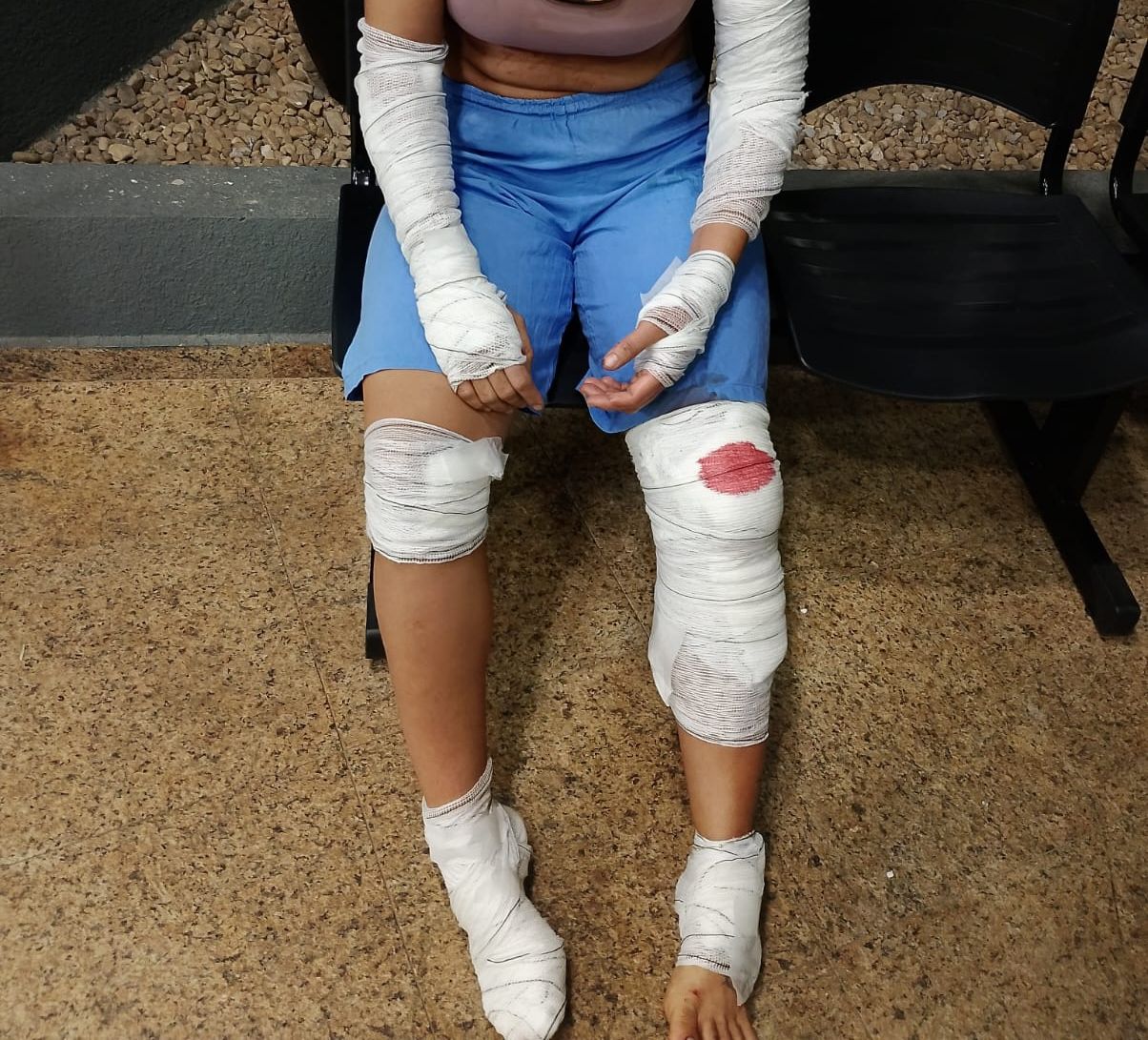 Mulher pula de carro que estava a 100km/h para escapar de feminicídio em Paulínia